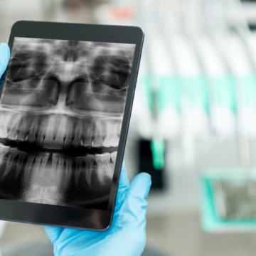 Pearl brings dental disease AI detection to more than 35,000 Canadian ClearDent software users – Oral Health Group
