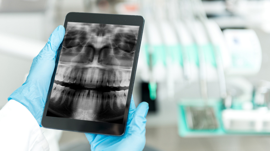 wp-header-logo-2154.png Pearl brings dental disease AI detection to more than 35,000 Canadian ClearDent software users – Oral Health Group