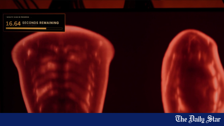 wp-header-logo-2294.png AI firm Midjourney launches medical venture built around ultrasound imaging – The Daily Star