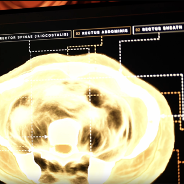AI image firm Midjourney spins up health division, unveils ‘Ultrasonic CT’ – R&D World