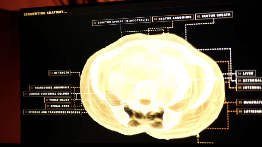 wp-header-logo-716.png Midjourney, The AI Image Generator, Is Developing A Full-Body Ultrasonic Scanner – Engadget