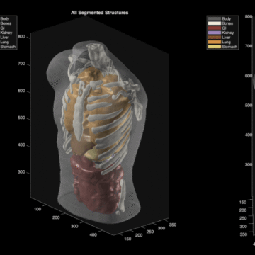 Midjourney goes from generating cat images to full-body ultrasound scans – The Verge