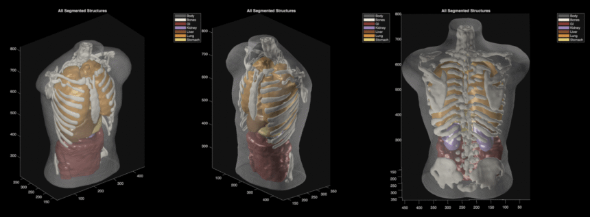 Midjourney goes from generating cat images to full-body ultrasound scans – The Verge
